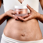 SoKind - Love lines Strækmærke creme